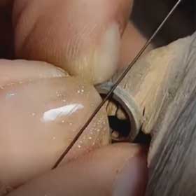 گام سوم: آماده‌سازی حلقه‌ها برای فرم بیزل